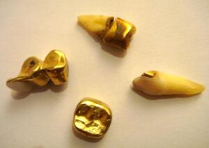 20-POW camp currency-gold capped teeth